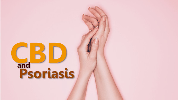 How does CBD work for Psoriasis
